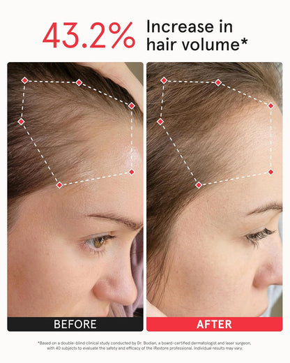 Unlock Your Hair's Potential: The iRestore Pro with 282 Laser and LED Beams for Ultimate Hair Restoration