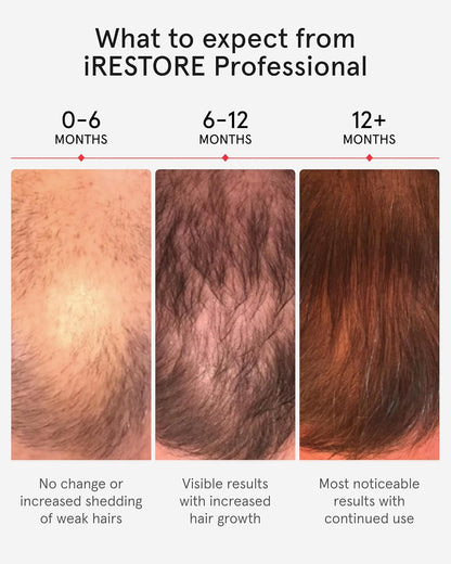 Unlock Your Hair's Potential: The iRestore Pro with 282 Laser and LED Beams for Ultimate Hair Restoration