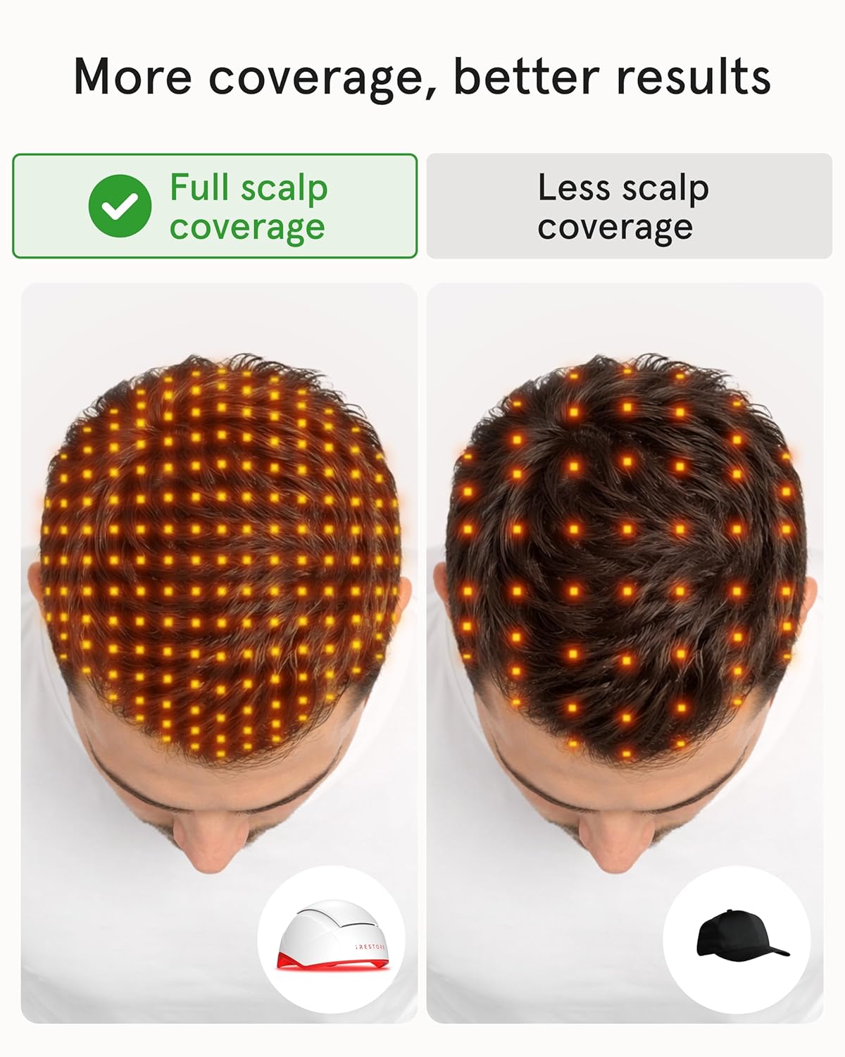 Unlock Your Hair's Potential: The iRestore Pro with 282 Laser and LED Beams for Ultimate Hair Restoration