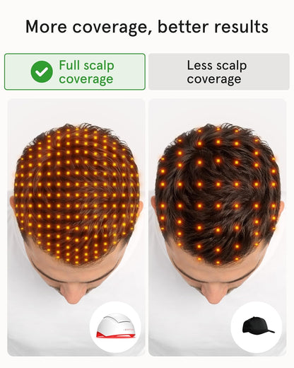 Unlock Your Hair's Potential: The iRestore Pro with 282 Laser and LED Beams for Ultimate Hair Restoration